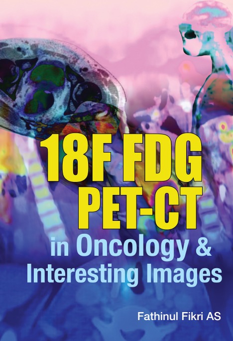 18F FDG PET-CT in Oncology & Interesting Images