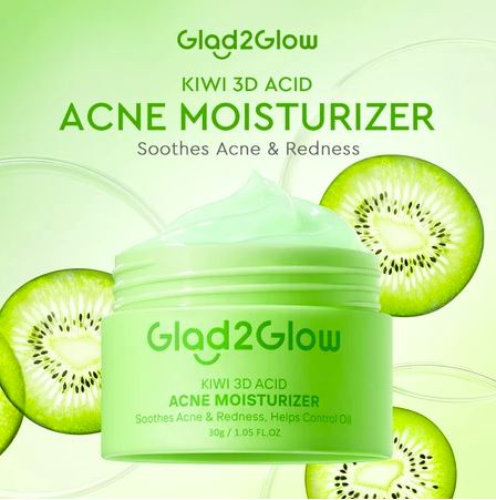 Glad2Glow KIWI 3D Acid Acne Moisturizer （30g）Acne Treatment Night Cream Face Acne Cream Skincare Moi