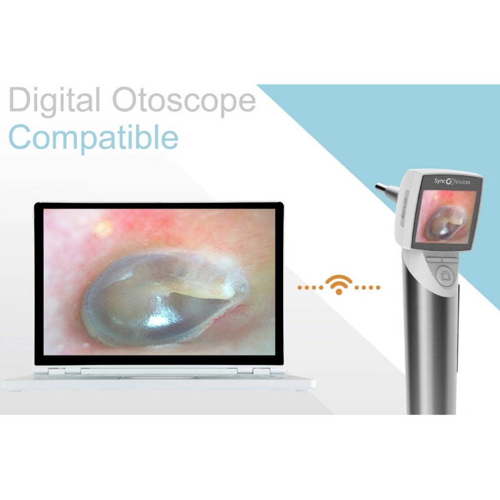 SYNCVISION – DIGITAL OTOSCOPE – iO1 ELITE